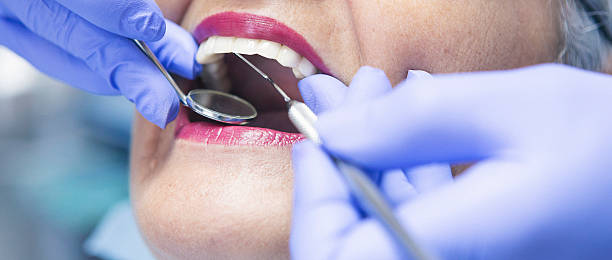 Best Emergency Tooth Extraction in Merriam Woods, MO